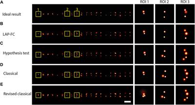 Spatiotemporal Clustering of Repeated Super-Resolution Localizations via Linear Assignment Problem